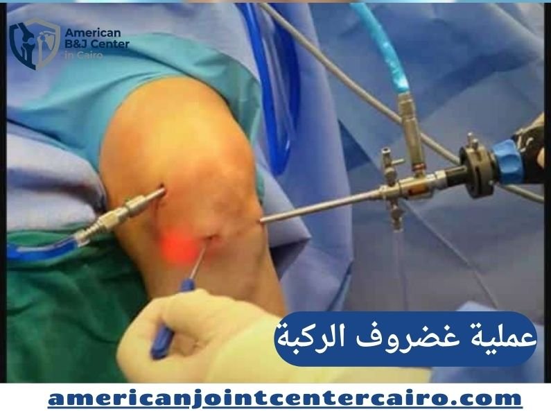 تجربتي مع عملية غضروف الركبة: من الألم إلى التعافي برعاية المركز الأمريكي لمناظير الركبة والكتف