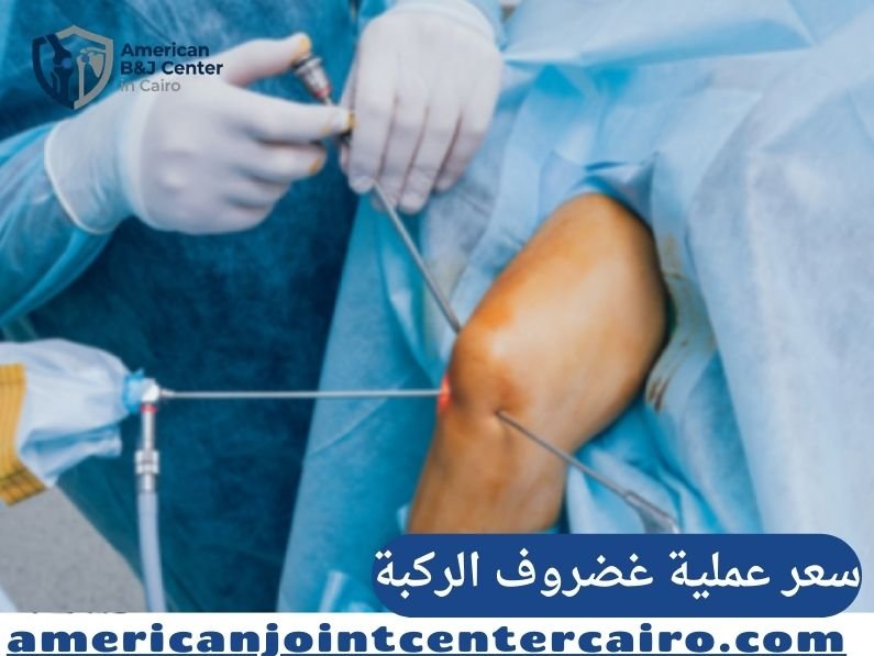 سعر عملية غضروف الركبة في مصر