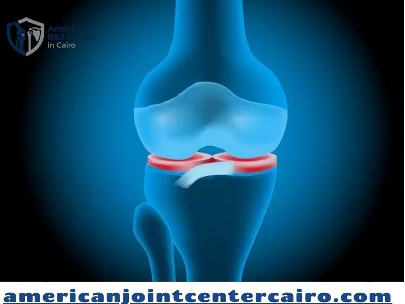 دليل أدوية لعلاج غضروف الركبة وسبل التعافي الحديثة