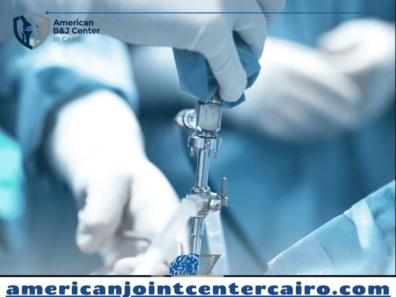 أسعار عمليات منظار الركبة في مصر