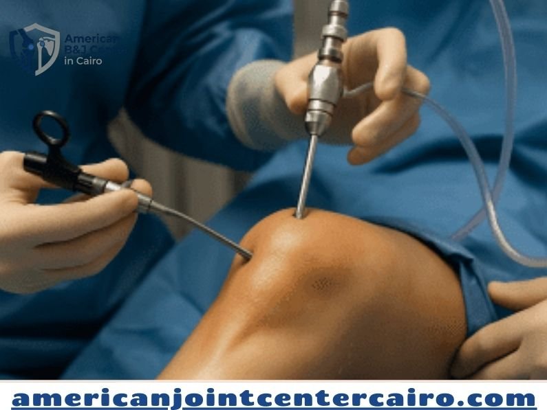 أسعار عمليات منظار الركبة في مصر