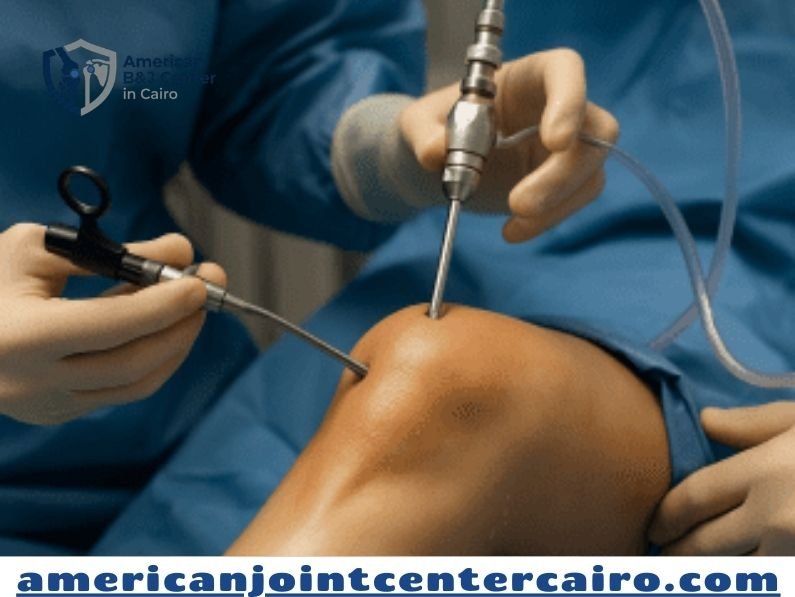 ما بعد عملية منظار الركبة: دليل شامل للتعافي والعودة للحياة الطبيعية