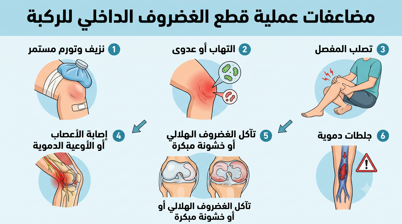 مضاعفات عملية الغضروف الداخلي للركبة