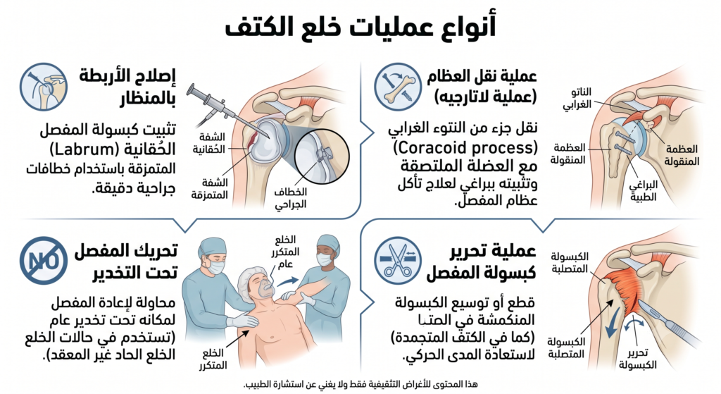 أنواع عملية خلع الكتف