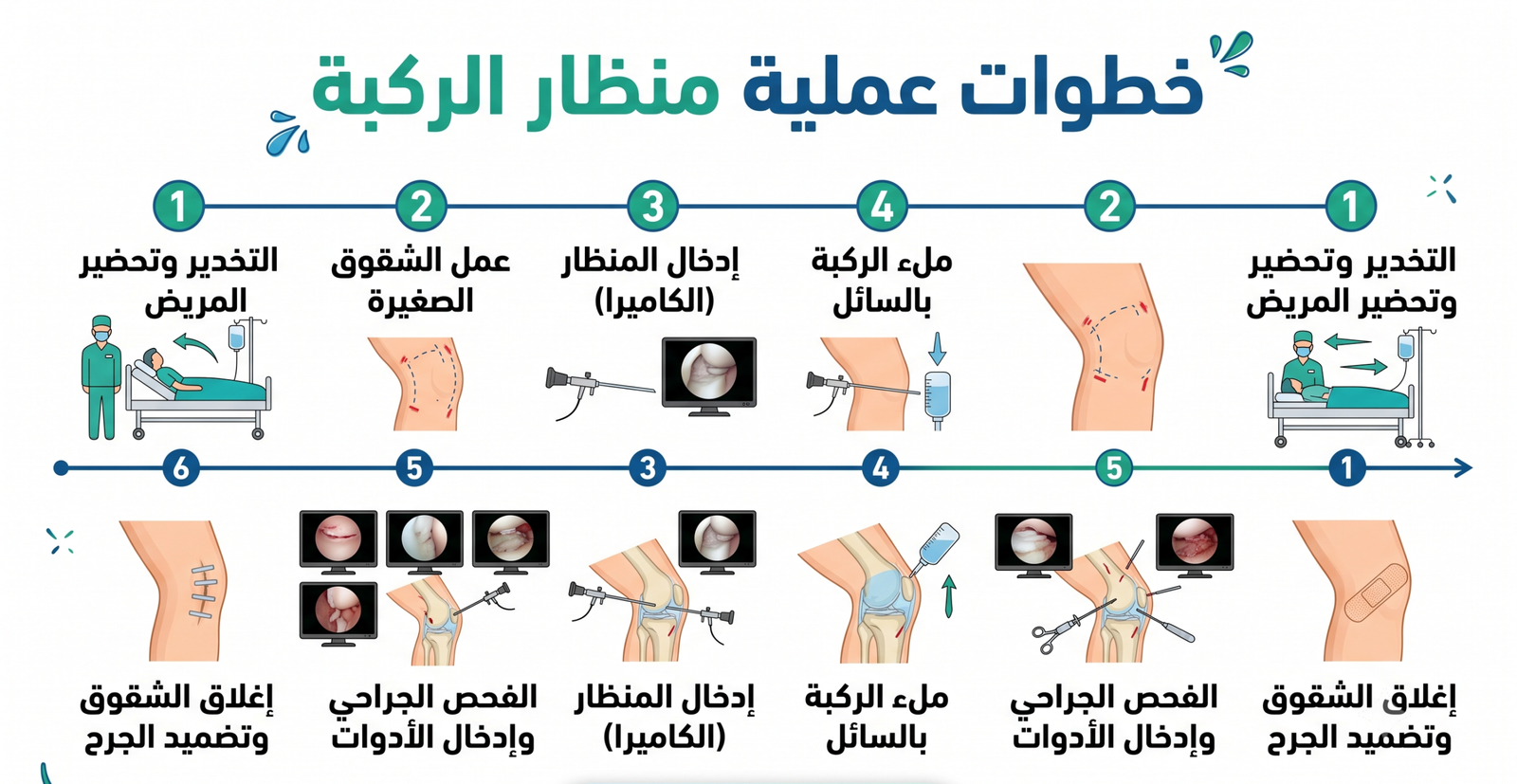 خطوات عملية منظار الركبة